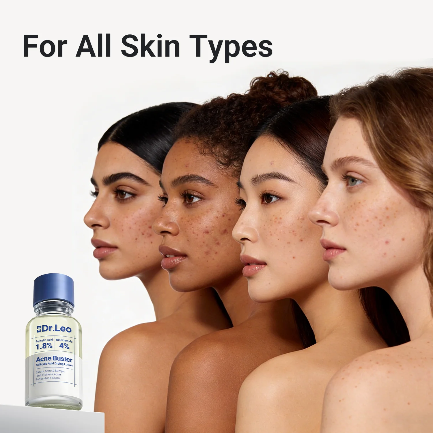 Acne Drying Lotion Plus — 2 Pack (20 mL × 2) - Image 9