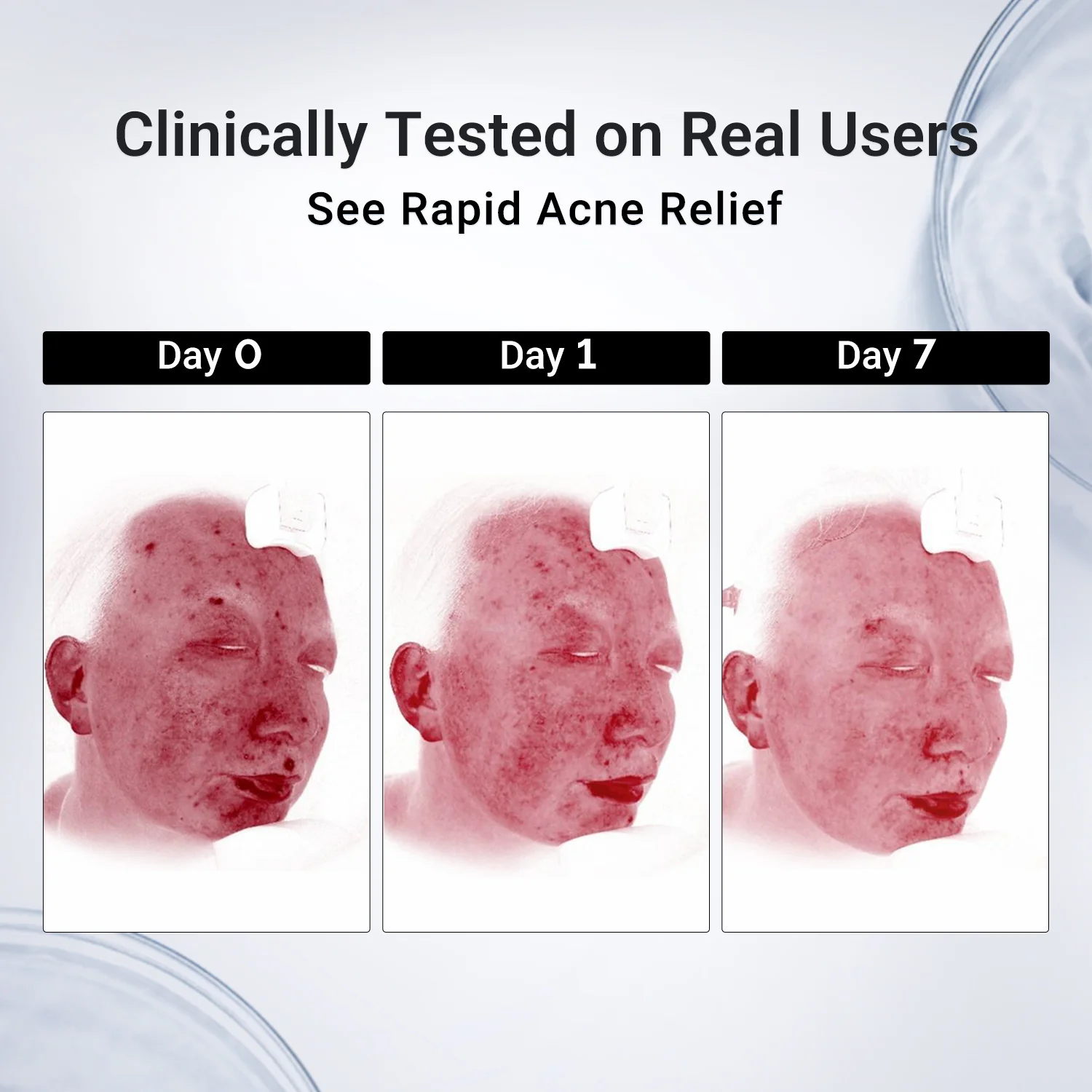 Acne Drying Lotion Plus (1.8% Encapsulated Salicylic Acid) — 20 mL - Image 8