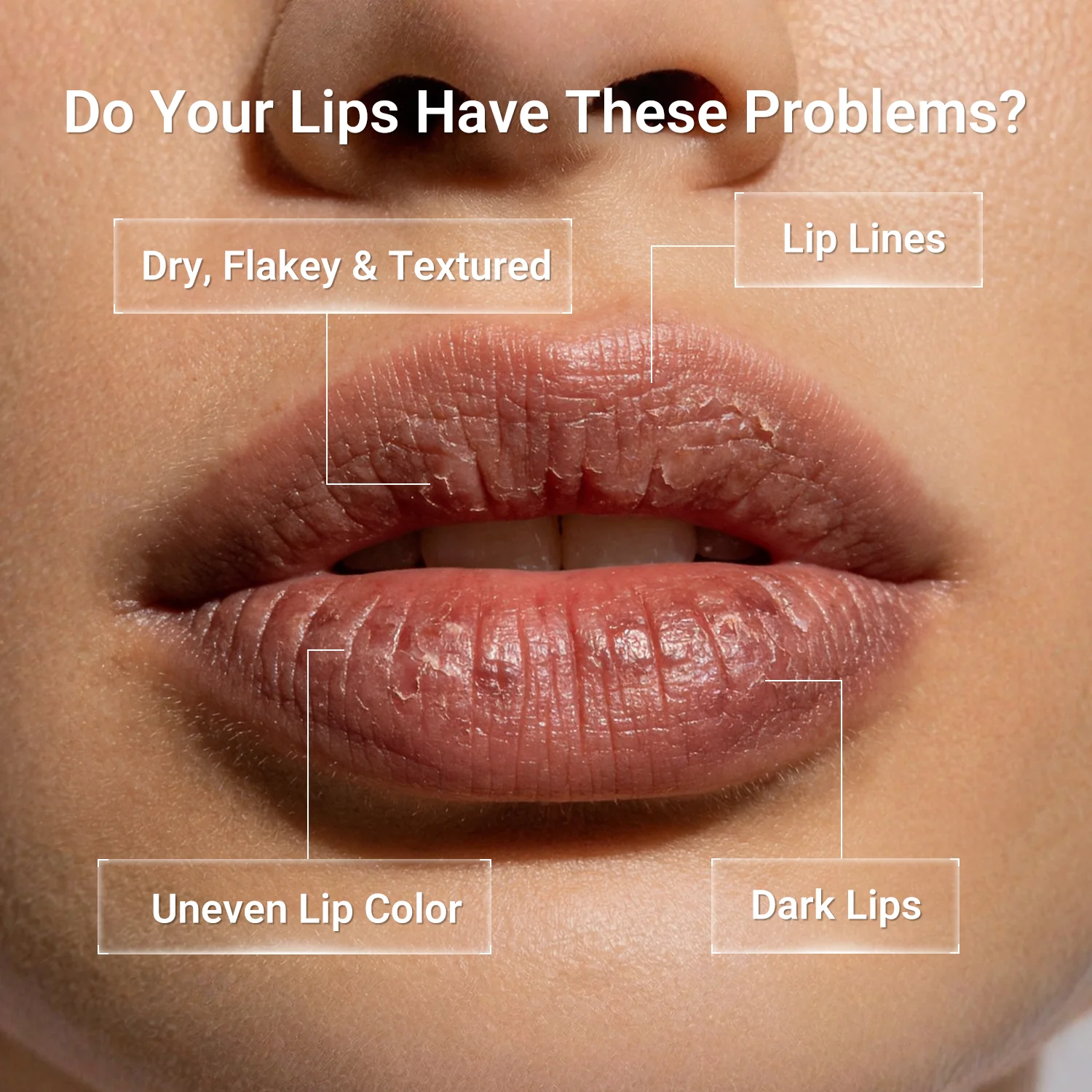 Peptides Nourishing Lip Serum - Image 3